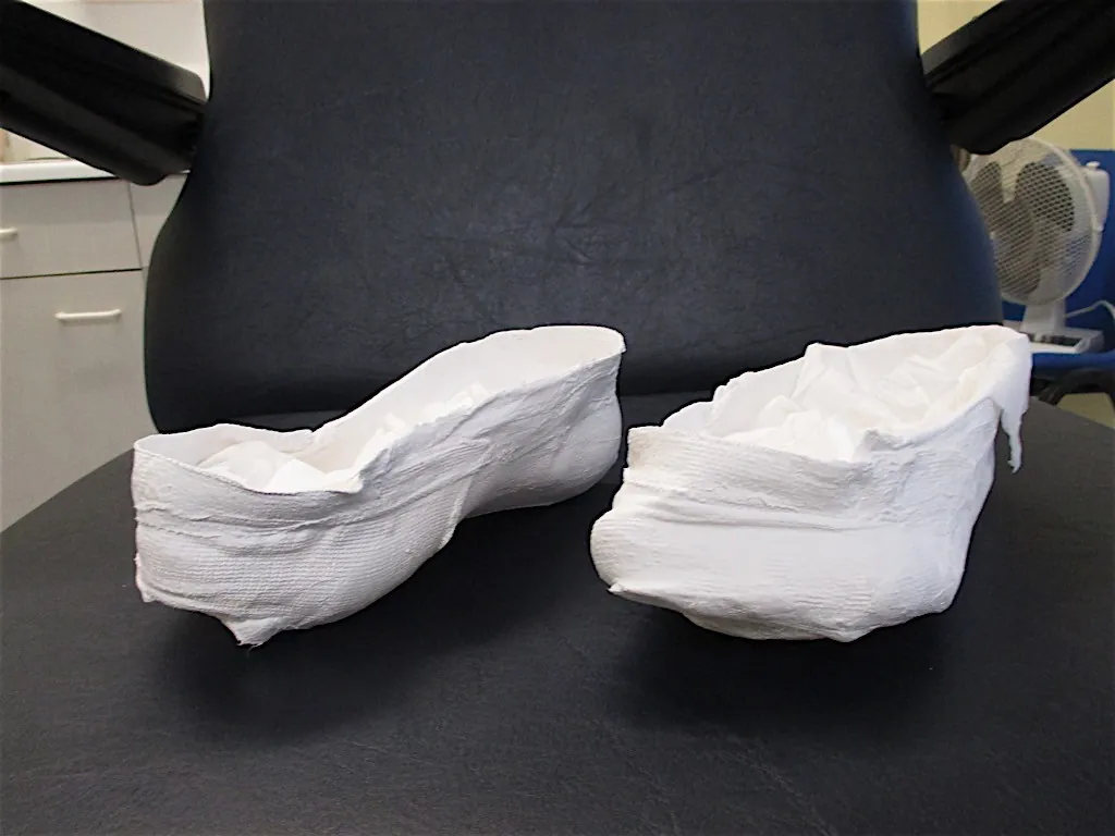 A pair of white foot casts on a clinic chair